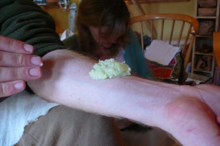 Onion Poultice For Healing